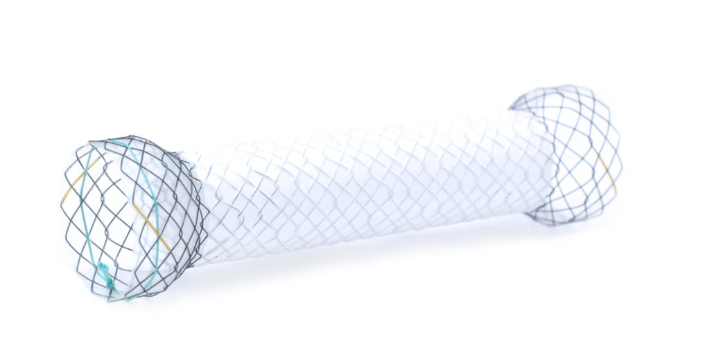 Hilzo Covered Pyloric/Colonic Stent